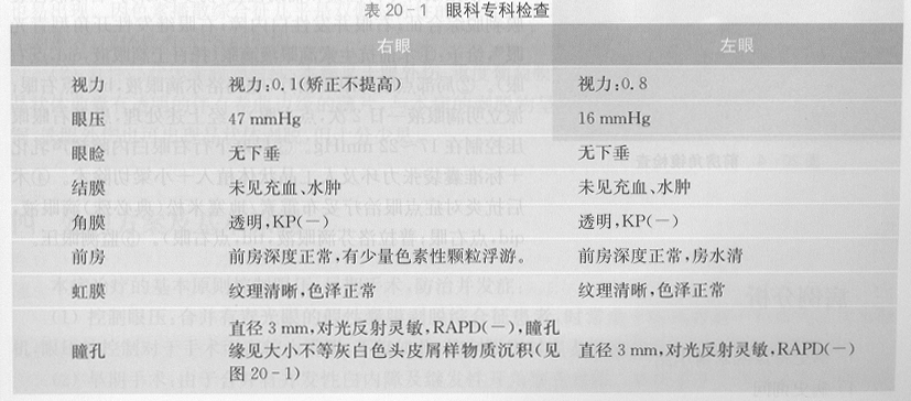ZY016_101_1.gif